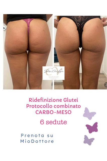 Carla Virgilio-2