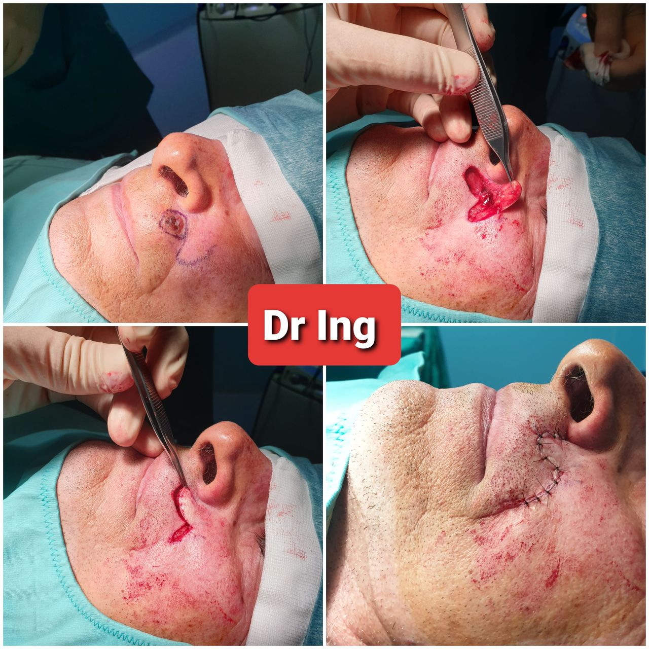 Andrea Ingegneri-1