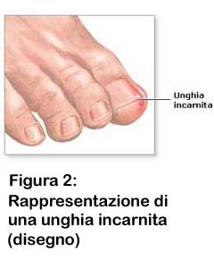 Ferruccio Boffi-0
