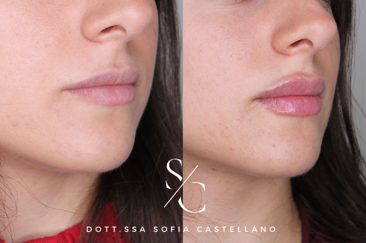 Sofia Castellano-0