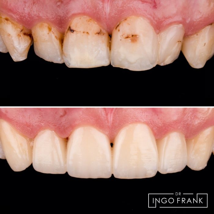 Ingo Frank-2