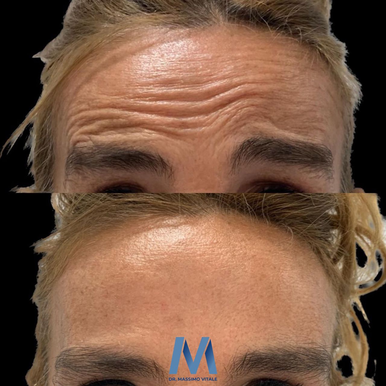 Massimo Vitale-1