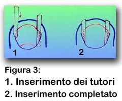 Ferruccio Boffi-2