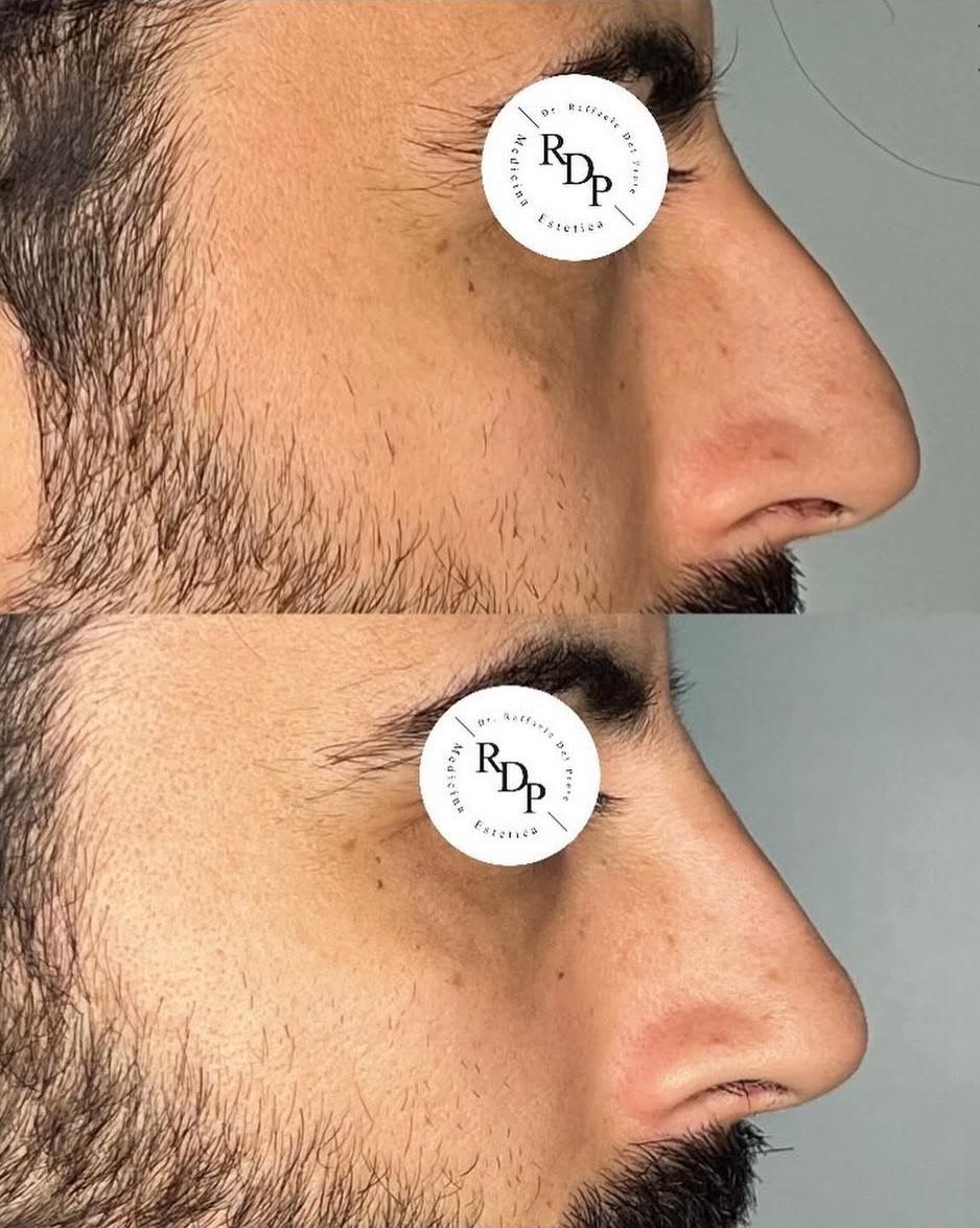 Raffaele Del Prete-0