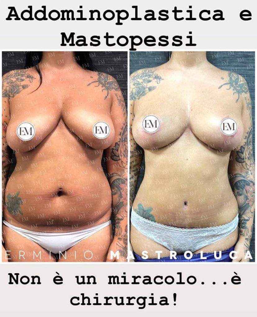 Francesco D'angelo-0