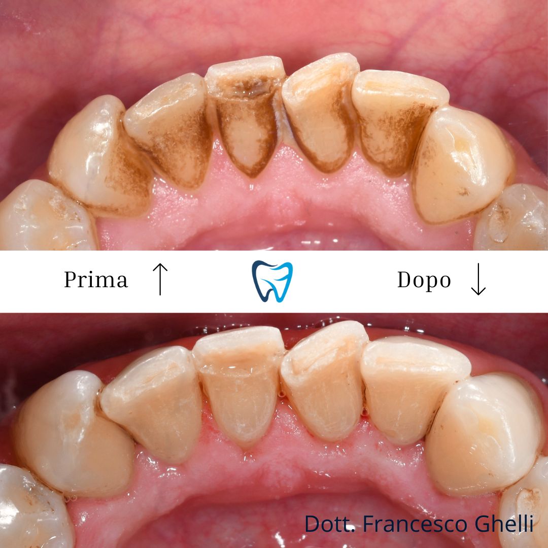 Francesco Ghelli-2