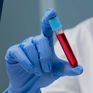 Powiększ obraz: Punkt pobrań  Veritas Med, diagnostyka Zgorzelec