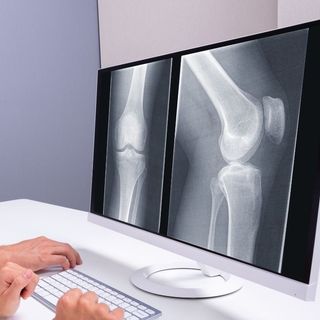 Ingrandire l'immagine: RX Radiografia, Radiologo San Marco Argentano stazione