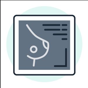 Tomosintesi Mammaria Centro Seen Studio di Radiologia