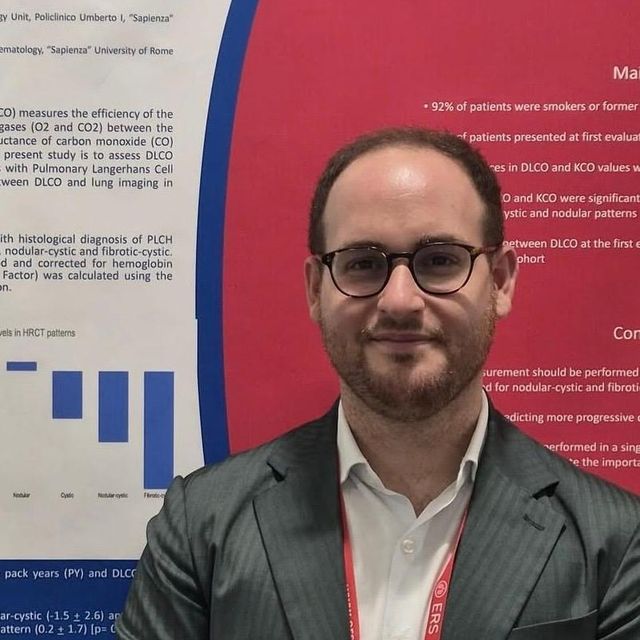Antonio Fabozzi, pneumologo Bulciago