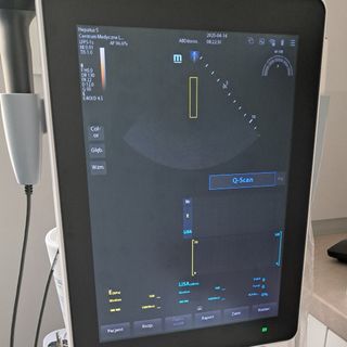 Powiększ obraz: Fibroscan Centrum Medyczne L4med , diagnostyka Wrocław