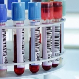 Glab Centro Prelievi ICOM, tecnico sanitario Cinisello Balsamo