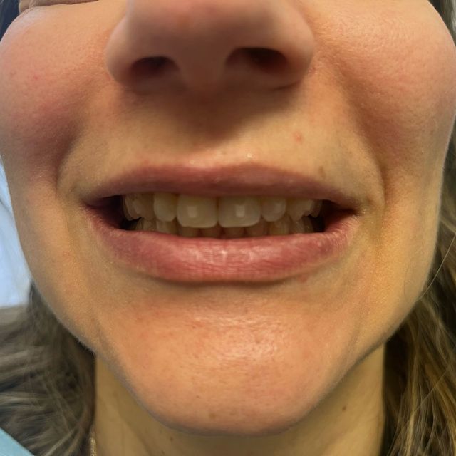 Ingrandire l'immagine: certificate 10