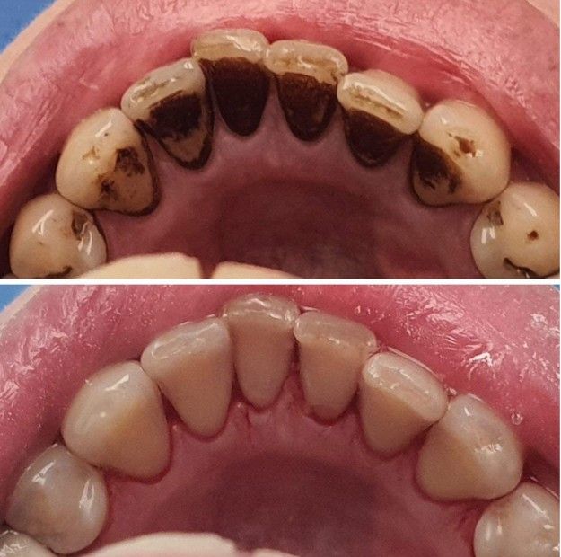 Ingrandire l'immagine: certificate 1