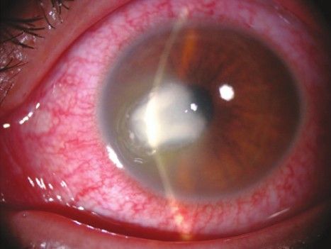 Ingrandire l'immagine: Studio Medico Oculistico Confalonieri e Ferraro di Carpi - Carpi (MO)