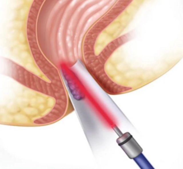 Ingrandire l'immagine: Ospedale SS Salvatore - Paternò