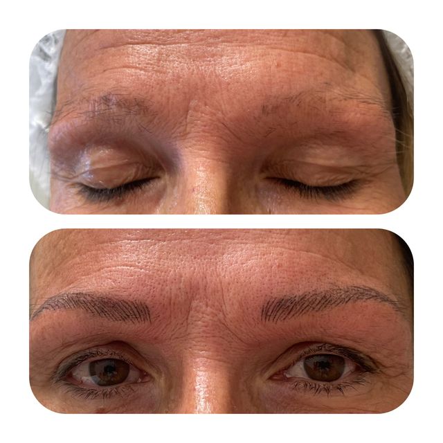 Acercar imagen: Micropigmentación y Borrado