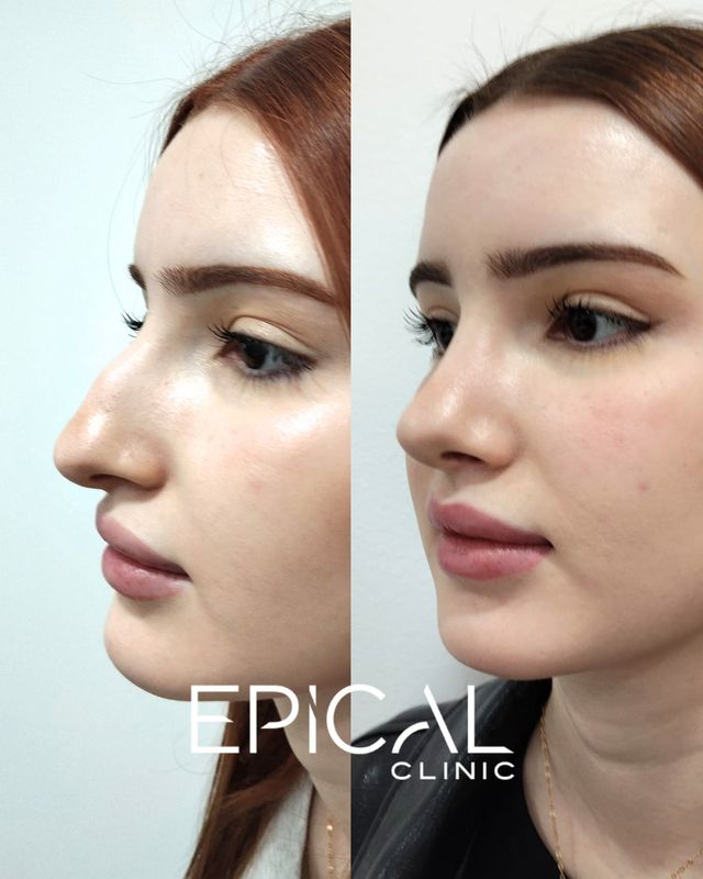 Acercar imagen: Epical Clinic Murcia