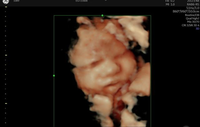 Acercar imagen: Clínica Guardamar y Psicotécnico en Guardamar CRC-A0182