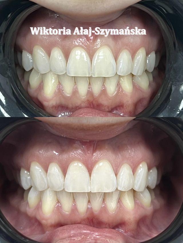 Powiększ obraz: Klinika Stomatologiczna Prestige Dental - Warszawa Żoliborz