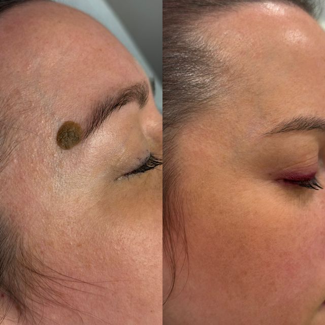 Acercar imagen: Clínica Dermatológica Domper