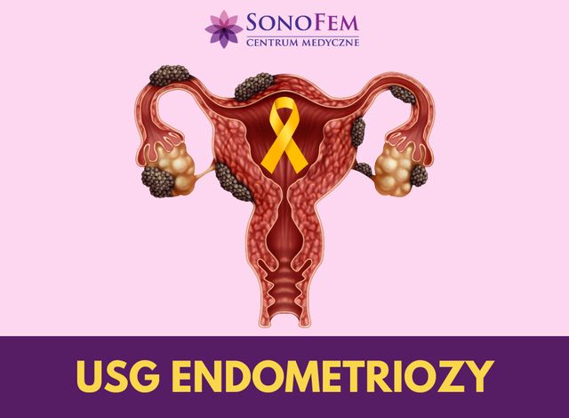 Powiększ obraz: SonoFem Centrum Medyczne