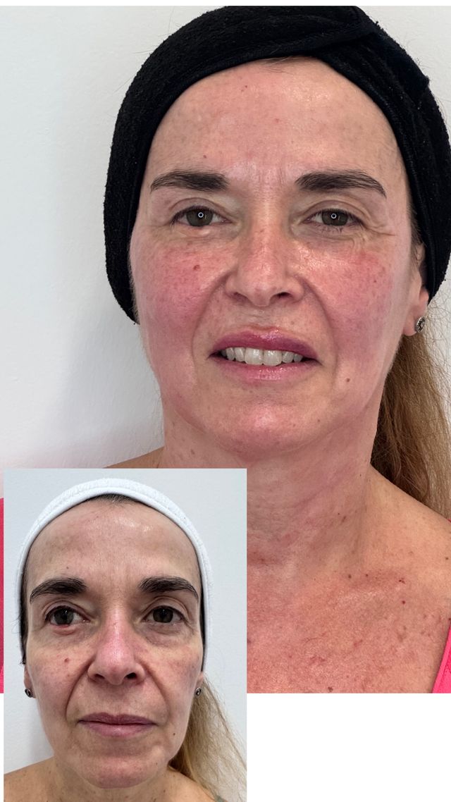 Acercar imagen: Clínica Cyrene I Medicina Estética Antienvejecimiento