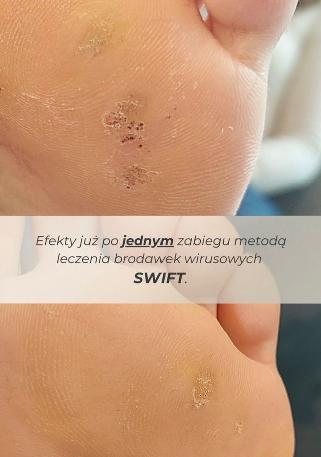 Powiększ obraz: Gold Medica Podologia