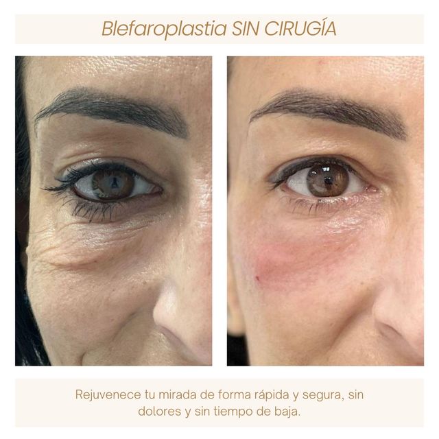 Acercar imagen: AC MEDICINA ESTÉTICA Y CAPÌLAR