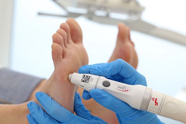 Powiększ obraz: INSTYTUT PODOLOGII Podologia PODOCHIRURGIA