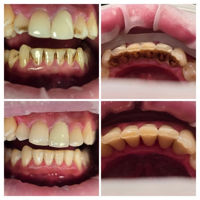 Powiększ obraz: MEDICADENT CENTRUM STOMATOLOGII, IMPLANTOLOGII I ORTODONCJI W LUBLINIE