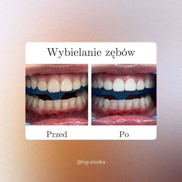 Powiększ obraz: Komplemed - Stomatolog, Medycyna Estetyczna, Rehabilitacja