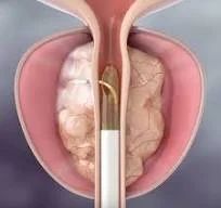 Acercar imagen: CLINICA UROLÓGICA ARRABAL & GUTIÉRREZ