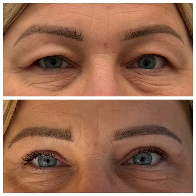 Powiększ obraz: OPTÉA FACE LAB