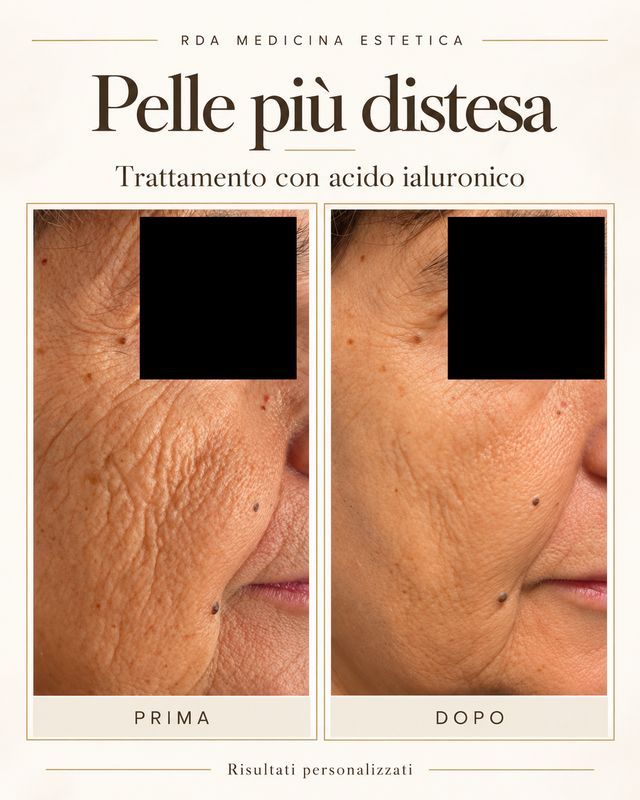 Ingrandire l'immagine: RDA Medicina Estetica