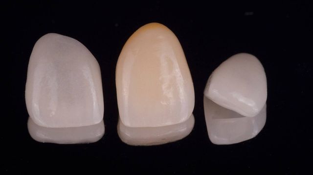 Acercar imagen: Clínica Dental Avinguda