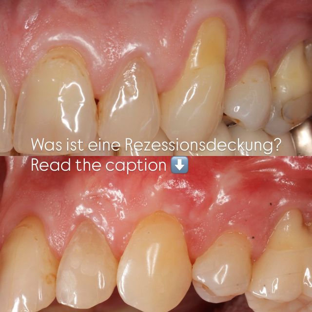 Bild vergrößern: Zahnarzt Dr. med. dent. Kai Zwanzig  Praxis für Zahnheilkunde - Kompetenzzentrum Implantologie Bielefeld