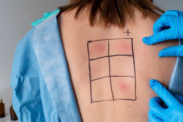 Ingrandire l'immagine: Studio privato Dr. Stefano Pattini Allergologia