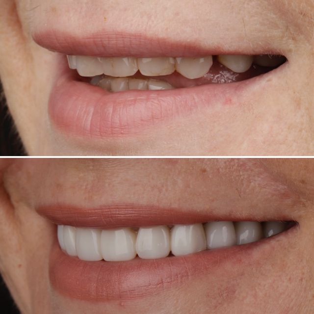 Powiększ obraz: "Galeria Uśmiechu" Centrum Stomatologii Estetycznej, stomatolog Kraków