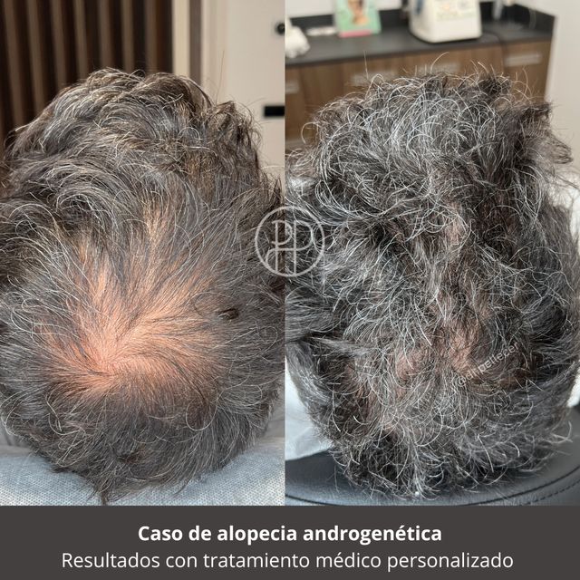 Acercar imagen: Clínic Lleida