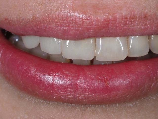 Powiększ obraz: Klinika Stomatologiczna Prestige Dental - Warszawa Żoliborz