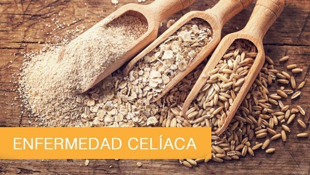 Acercar imagen: Consulta Online