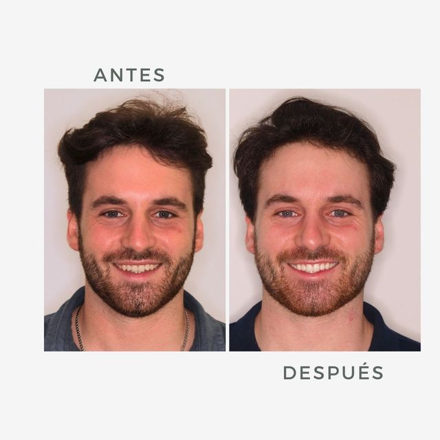 Acercar imagen: Clinica Marien Morata Roig Odontología Estética