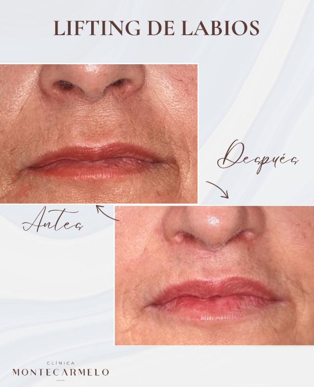 Acercar imagen: Clínica Montecarmelo