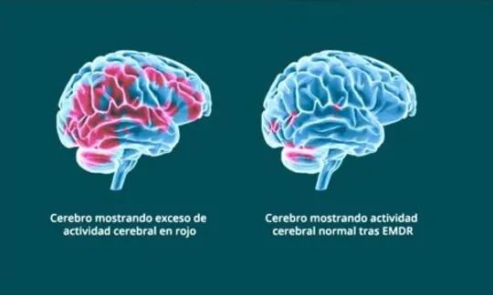 Acercar imagen: Consulta virtual (a distancia)