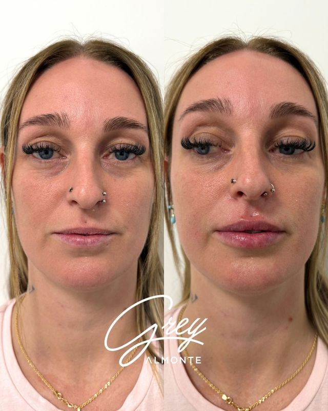 Acercar imagen: Epical clinic