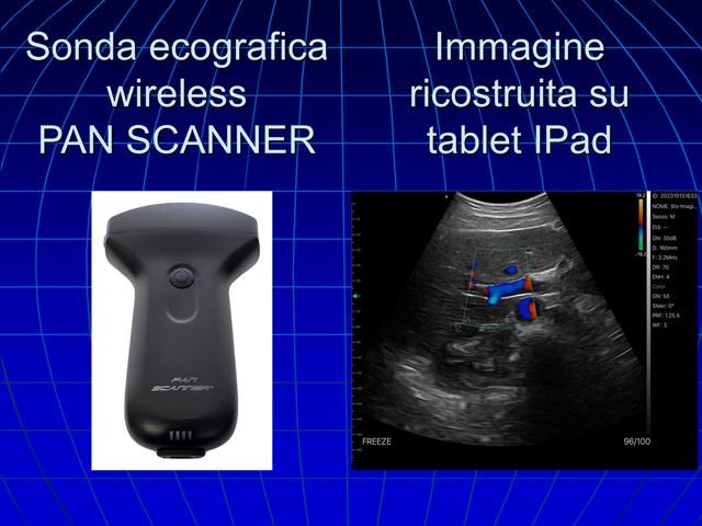 Ingrandire l'immagine: Ostia Radiologica
