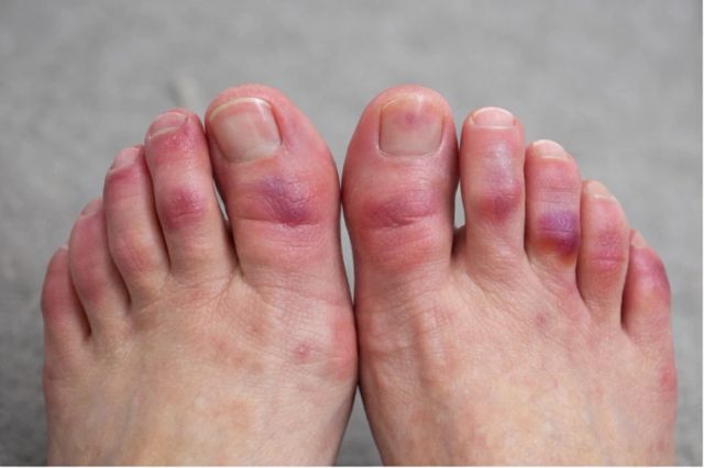 Acercar imagen: Aquiles Clínica del Pie