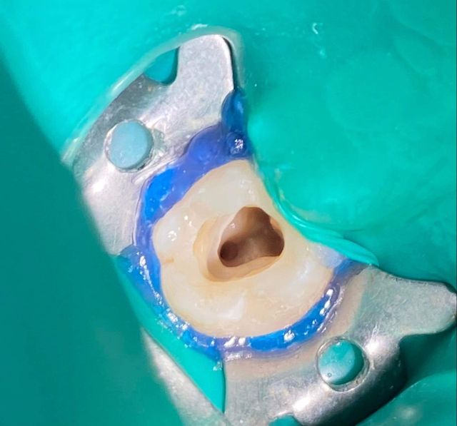 Powiększ obraz: Kaya Dent