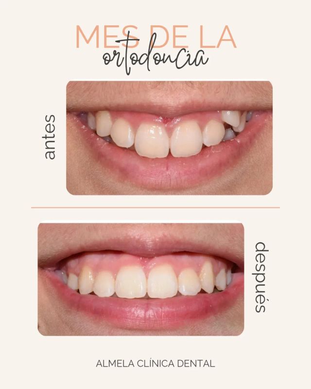 Acercar imagen: ALMELA CLÍNICA DENTAL